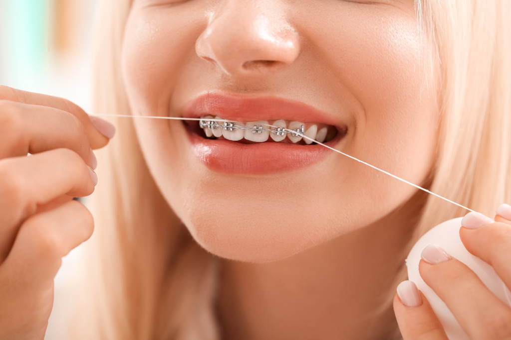 How Often Should I Floss With Braces?