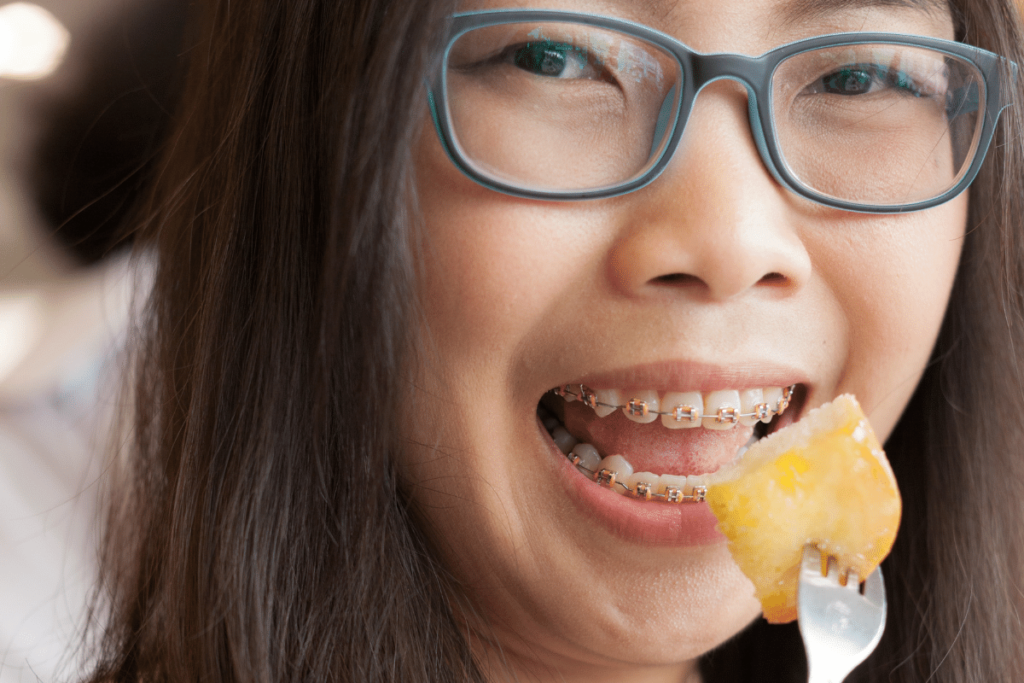Eating with braces
