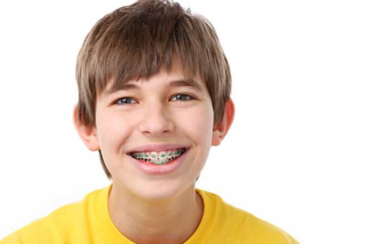 How to Prepare Children for Getting Braces