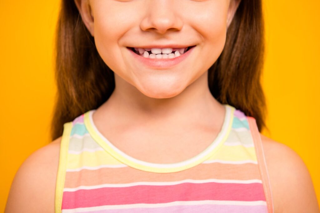 Early Orthodontic Treatment for Children.