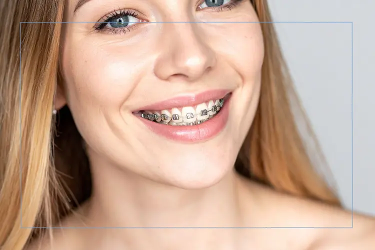Close up of a woman smiling with braces.