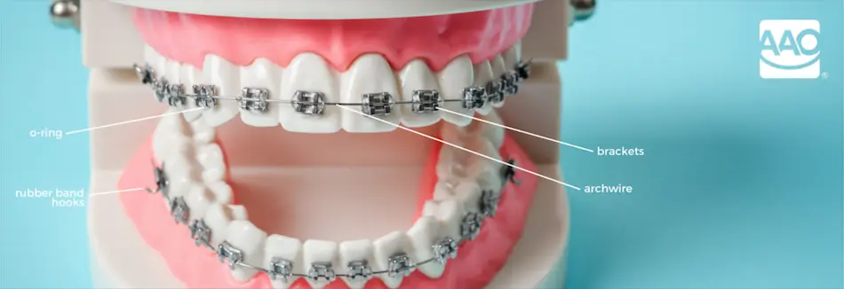 Orthodontic Problems Header